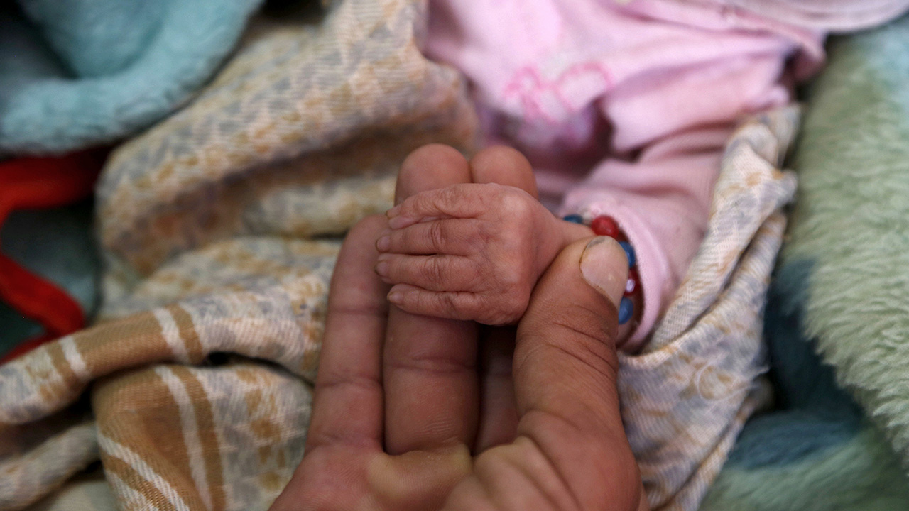 Salgın hastalık vakalarının da artış gösterdiği Yemen`deki durumdan en çok çocuklar etkileniyor.