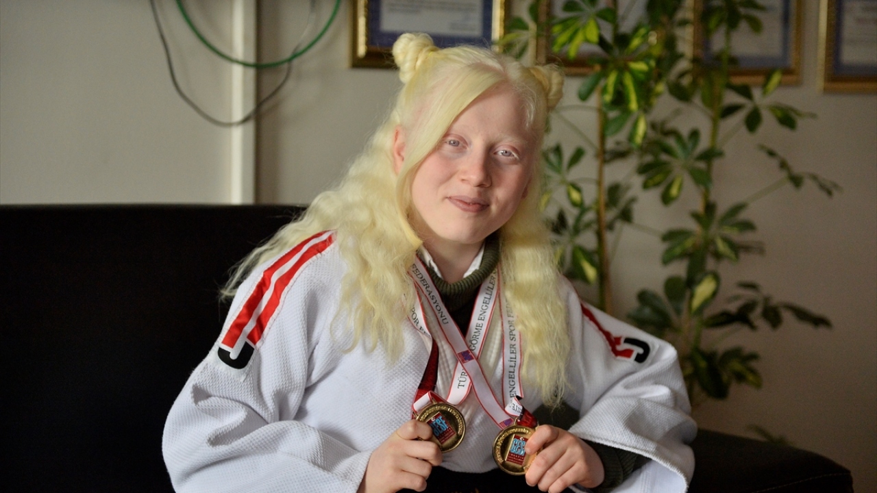 Kızıltepe Cumhuriyet Anadolu Lisesi 10`uncu sınıfta okuyan Ruken Adıgüzel, çocuk yaşta kendisi gibi albino hastası ağabeyine özenerek judoya başladı.