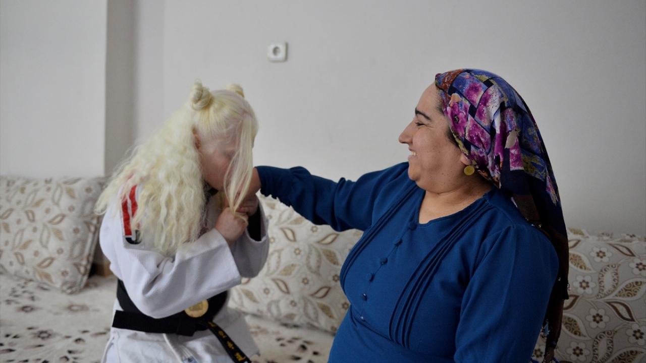 Ruken`in hedefi 2020 Tokyo Paralimpik Oyunları`na katılarak hem Türk bayrağını dalgalandırmak hem de engellilerin başarısını göstermek.