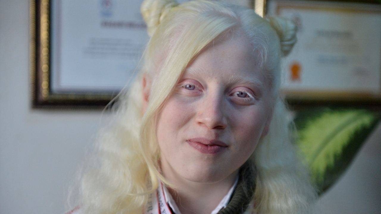 Sporun engel tanımadığına işaret eden Ruken Adıgüzel, engellilere spor yapmaları tavsiyesinde bulundu.