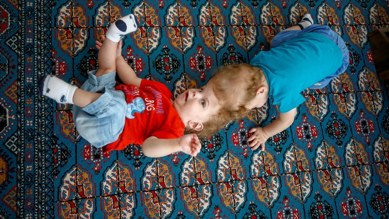 Bir restoranda çalışan 41 yaşındaki baba Ömer Evrensel de sürekli siyam ikizlerine ameliyat yapan merkezleri araştırdıklarını, yurt dışında bazı merkezler olduğunu anlattı.