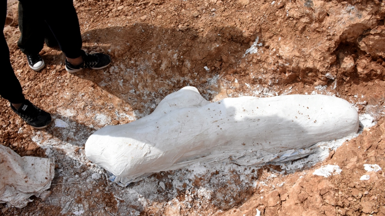 "Alçı ceket" yöntemiyle çıkarıldı