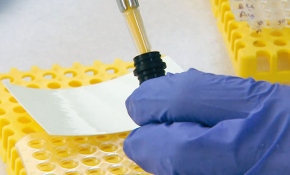 Sağlık Bakanlığı bulaşıcı hastalıkları "İzci" ile takip ediyor