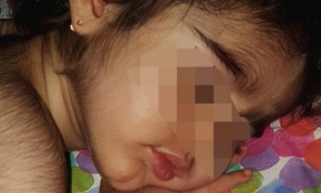 İspanya'da bebeklere mide ilacı yerine saçkıran ilacı verildi