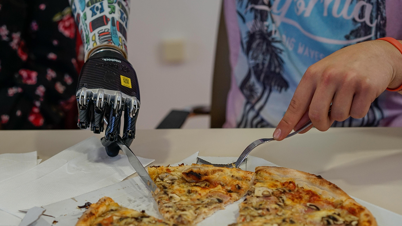 Bosna Hersek ve Balkanlar`da ilk kez gerçekleştirilen başarılı ameliyat sonucu düşünceleriyle kontrol edebildiği biyonik bir kola sahip olan Omerovic, bir Alman firması tarafından üretilen yeni koluyla adeta tekrar hayata tutundu.