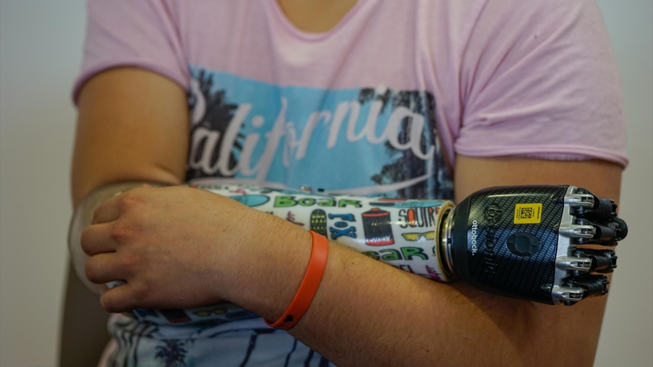 Yaklaşık 2 ay önce Saraybosna Üniversitesi Klinik Merkezi`nde (KCUS) başarılı bir ameliyat geçiren Omerovic, yaptığı açıklamada, kolunu iş makinesine kaptırdığını anlatarak 4 ay boyunca kolsuz kalmanın çok zor olduğunu söyledi.