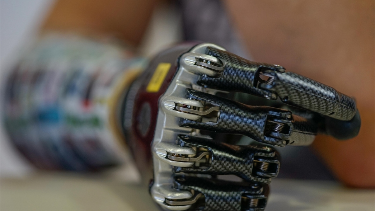 Biyonik kolun 14 farklı hareket özelliğine sahip olduğunu anlatan Omerovic, Ermin`in düşünce yoluyla gönderdiği sinyallerin biyonik kolu harekete geçirdiğini kaydetti.