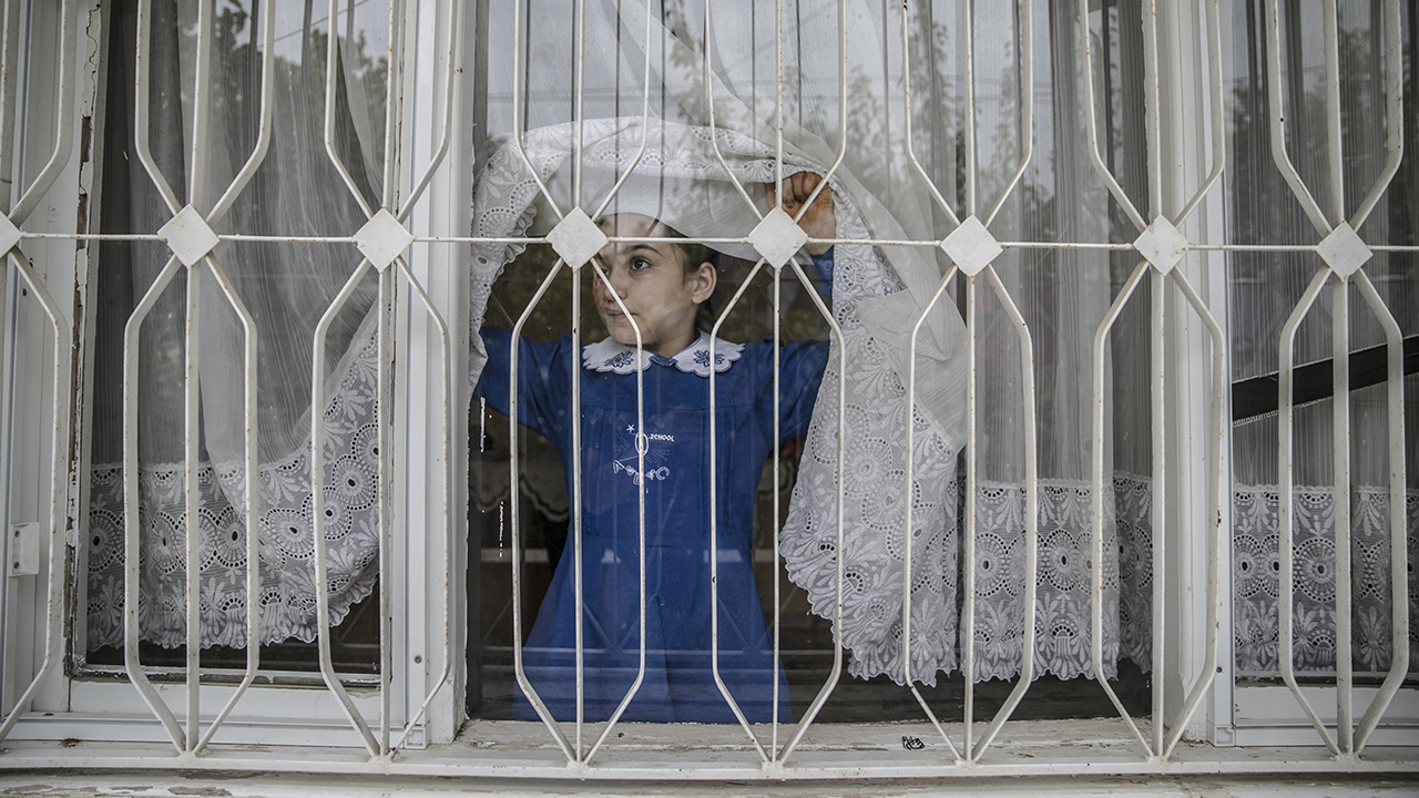 Evlerine isabet eden varil bombası nedeniyle yüzünün sağ bölümü yanan Luceyn, Türkiye`de geçirdiği başarılı operasyonla yeniden gülmeye başladı.