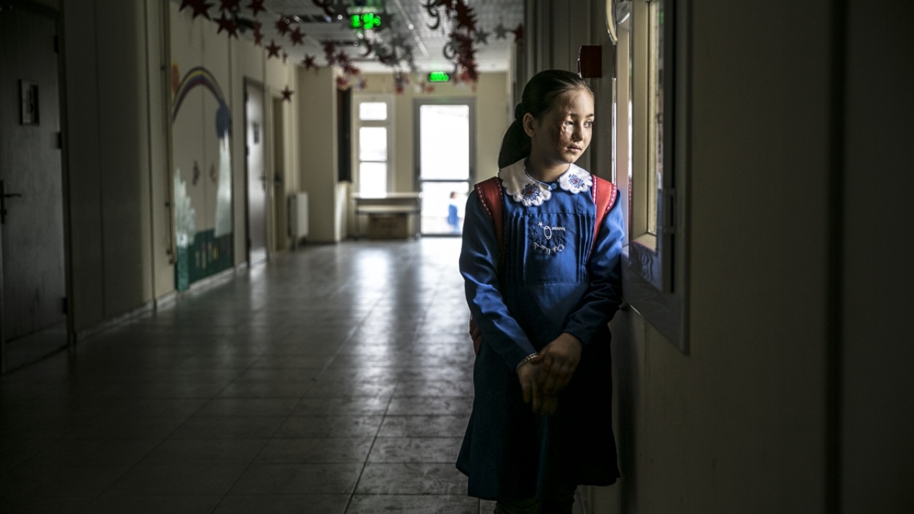 Saldırıda annesini, babasını, teyzesini ve 7 aylık oğlunu kaybettiğini anlatan Kifretune, olayda 7 yaşındaki oğlu Ömer`in sağ bacağını kaybettiğini ve kızı Luceyn`in de yüzünün yandığını belirtti.