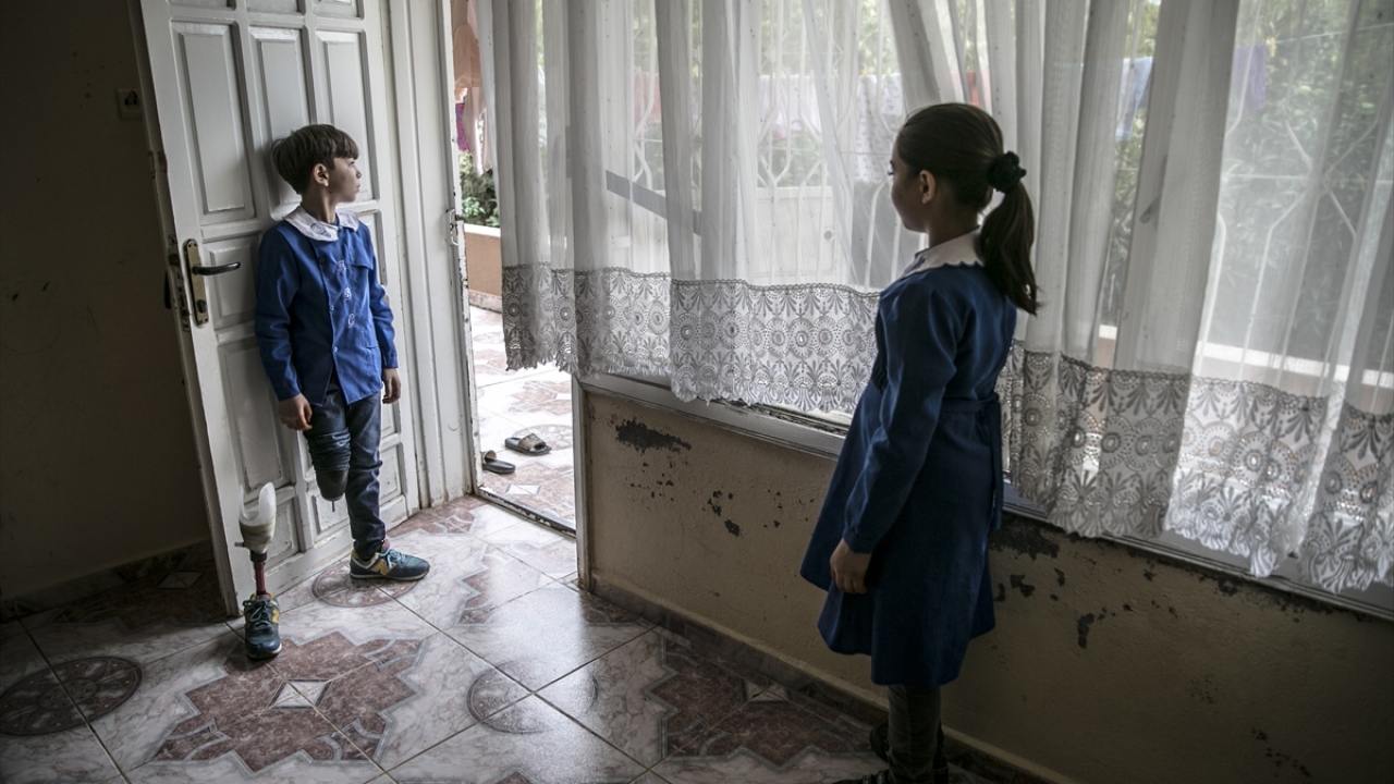 Bacağını kaybeden oğlu Ömer`e Suriye`de protez takıldığını aktaran baba Kifretune, saldırıda yüzü yanan kızı Luceyn`e ülkesinde tedavi imkanı bulamadığını kaydetti.