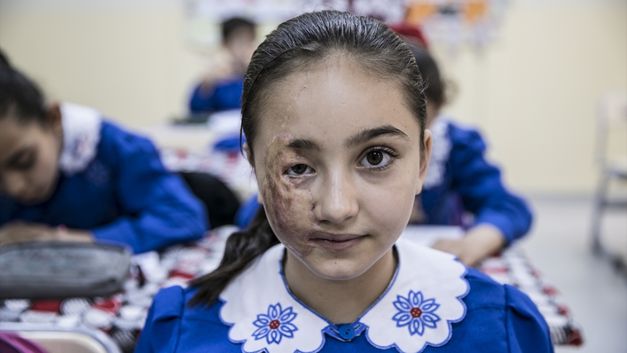 Türkiye`de geçirdiği başarılı operasyonlarla sağlığına kavuşan Luceyn de mutluluğunu dile getirdi.