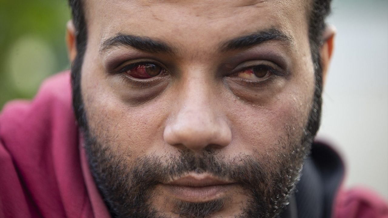 Demir çubuklarla dövüldüklerini iddia ettiler