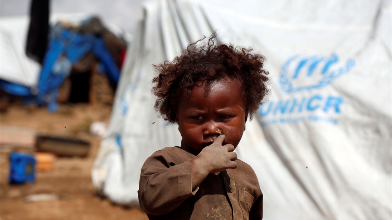 Başkent Sana`nın kuzeyindeki Amran vilayetinde bulunan Al-Reqah mülteci kampına sığınan Yemenliler, zor şartlar altında yaşamlarını sürdürmeye çalışırken, bu durumdan en çok çocuklar etkileniyor.