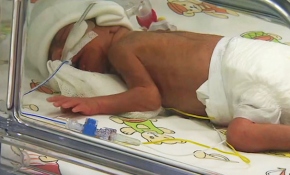 Türkiye'de 4 bin bebekten biri hipotiroidi ile dünyaya geliyor