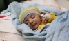 "Yaşamaz" denilen Ömer bebek, yaşam savaşını kazandı
