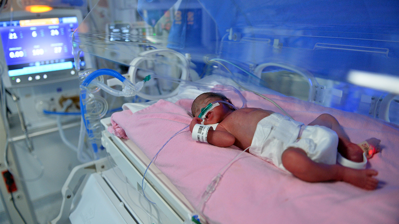 Halep`ten 5 yıl önce Türkiye`ye sığınan 27 yaşındaki Abdulmelik ve 21 yaşındaki Nesrin Hammud çiftinin dördüz bebekleri, hastanede sezaryenle dünyaya geldi.