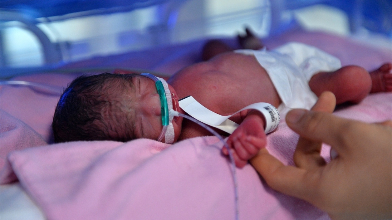 Çift, bebeklerine Türkiye ve Cumhurbaşkanı Recep Tayyip Erdoğan`a sevgilerinden dolayı "Recep Tayyip, Emine ile Muhammet ve Zeynep" adlarını verdi.