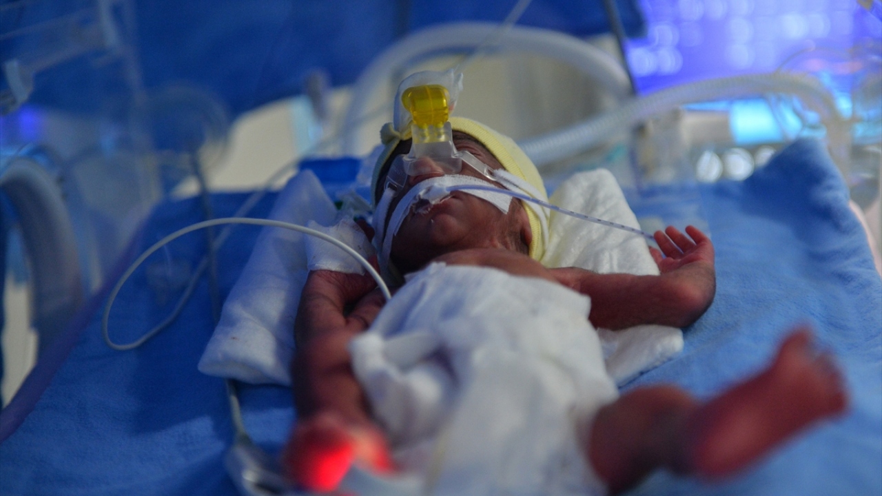 Bebekler için en uygun anda doğumu başlattıklarını ifade eden Gürbostan, "Dördüz bebeklerimiz dünyaya geldi. Annenin sağlık durumu iyi. Bebekler de gayet iyi, 32. haftada doğumu gerçekleştirdik." dedi.