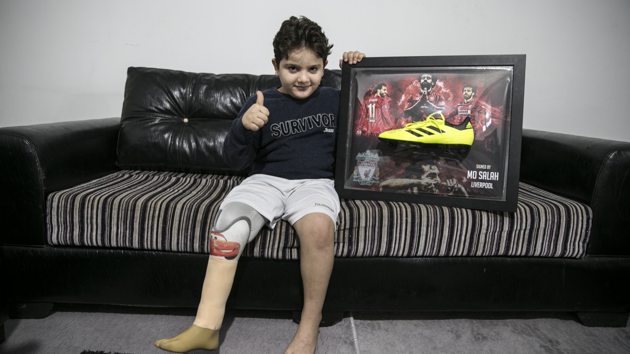 Rejime ait savaş uçakları tarafından 1,5 yıl önce İdlib kırsalına düzenlenen saldırıda sağ bacağını kaybeden Gacir, tedavisinin yapılabilmesi için babasıyla Hatay`ın Reyhanlı ilçesine geldi.