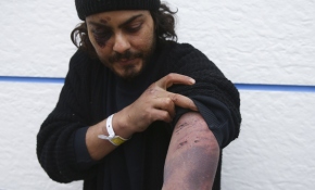 Mısırlı düzensiz göçmen: Yunan askerleri beni darbetti