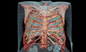COVID-19 akciğerlere nasıl zarar veriyor?