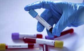 Koronavirüs laboratuvarda mı üretildi?