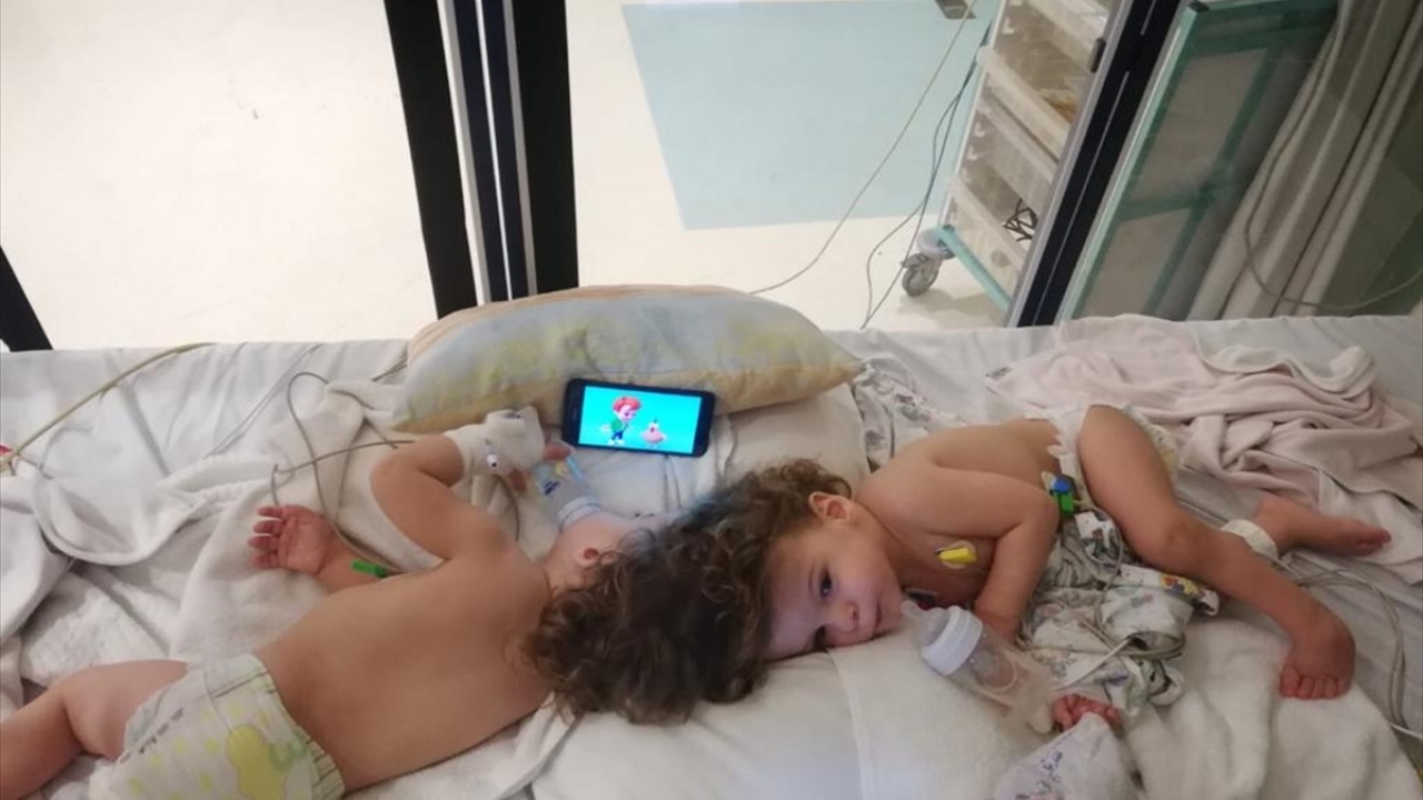 Aralarında iki Türk doktorun da bulunduğu 42 hekimin yer aldığı ekip, üç büyük operasyon gerçekleştirdi. Yapışık başları 28 Ocak`ta ayrılan Derman ve Yiğit`e hastanede bir süre tedavi uygulandı.