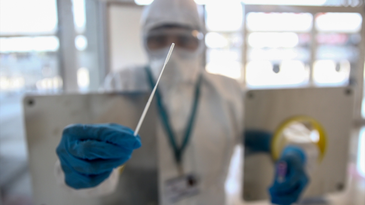 Bu arada, Kıbrıs`a seyahat edecek KKTC`nin Antalya Başkonsolosluğu Eğitim ve Kültür Ateşesi Mehmet Savaş Kortay, laboratuvarda numune veren ilk kişi oldu. 