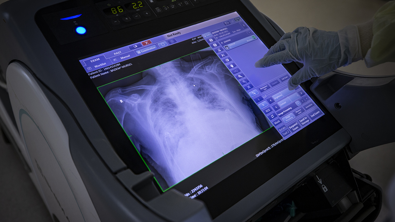 Salgının son 7 günlük etkisi