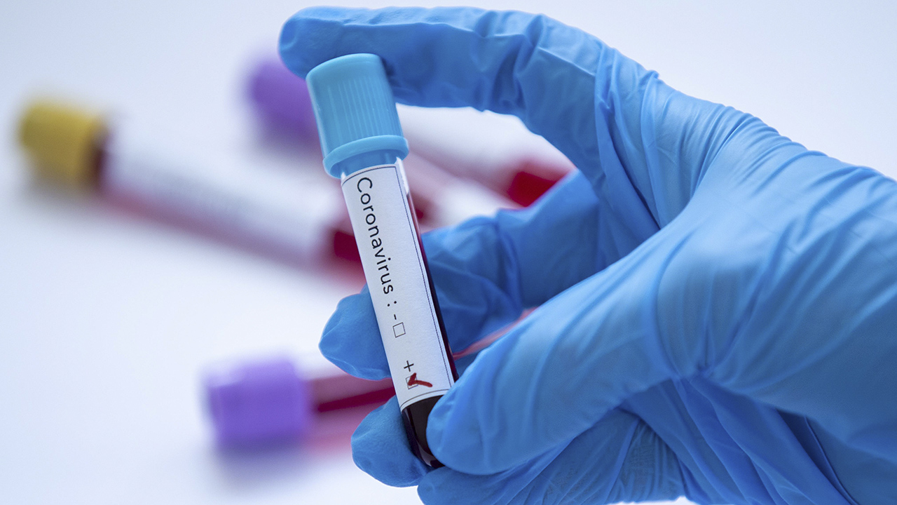 Vakaların demografik dağılımı