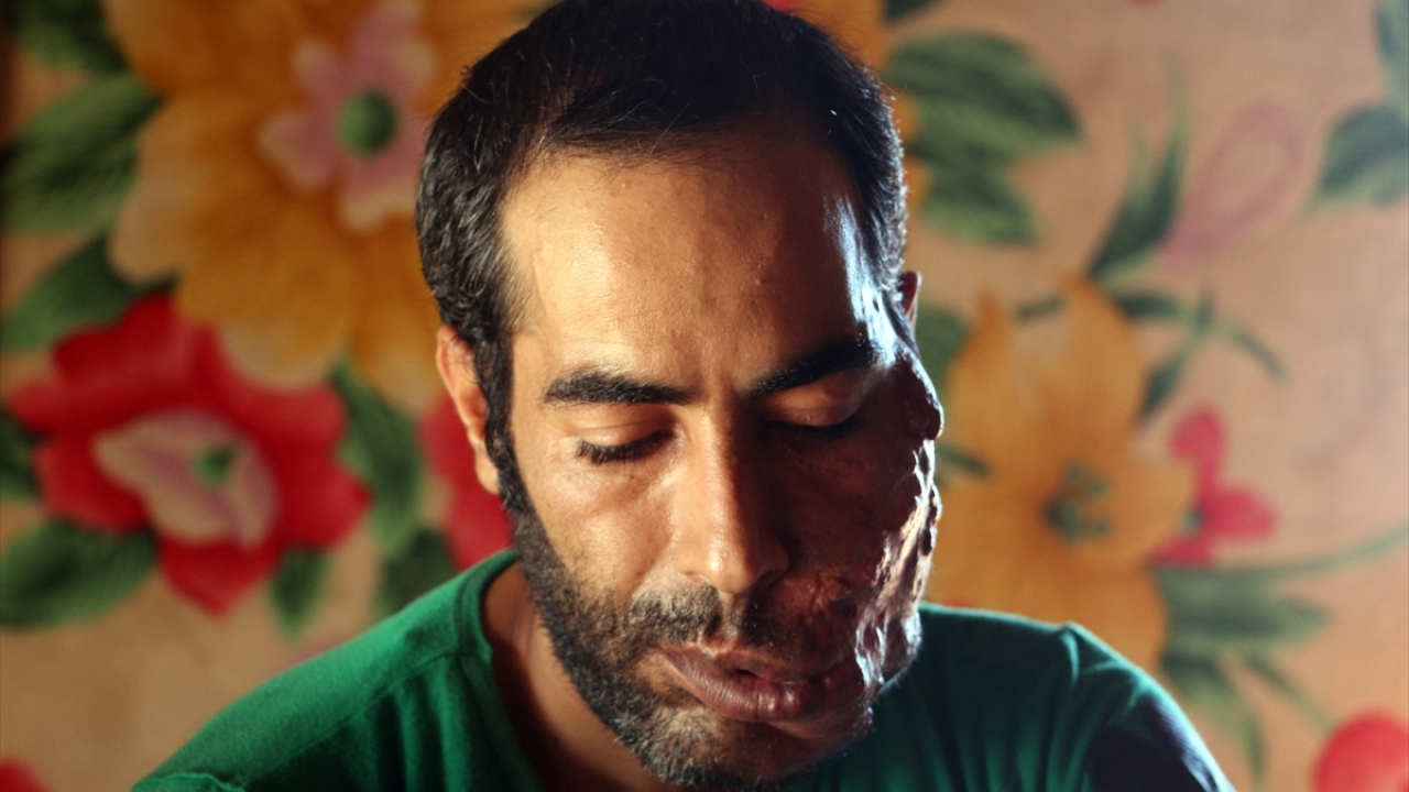 Aldığı yaralar sonrasında konuşma güçlüğü de çeken Mahir Ebu Muhammed, yüzündeki yara nedeniyle çocuklarının kendisinden korktuğunu söyledi.