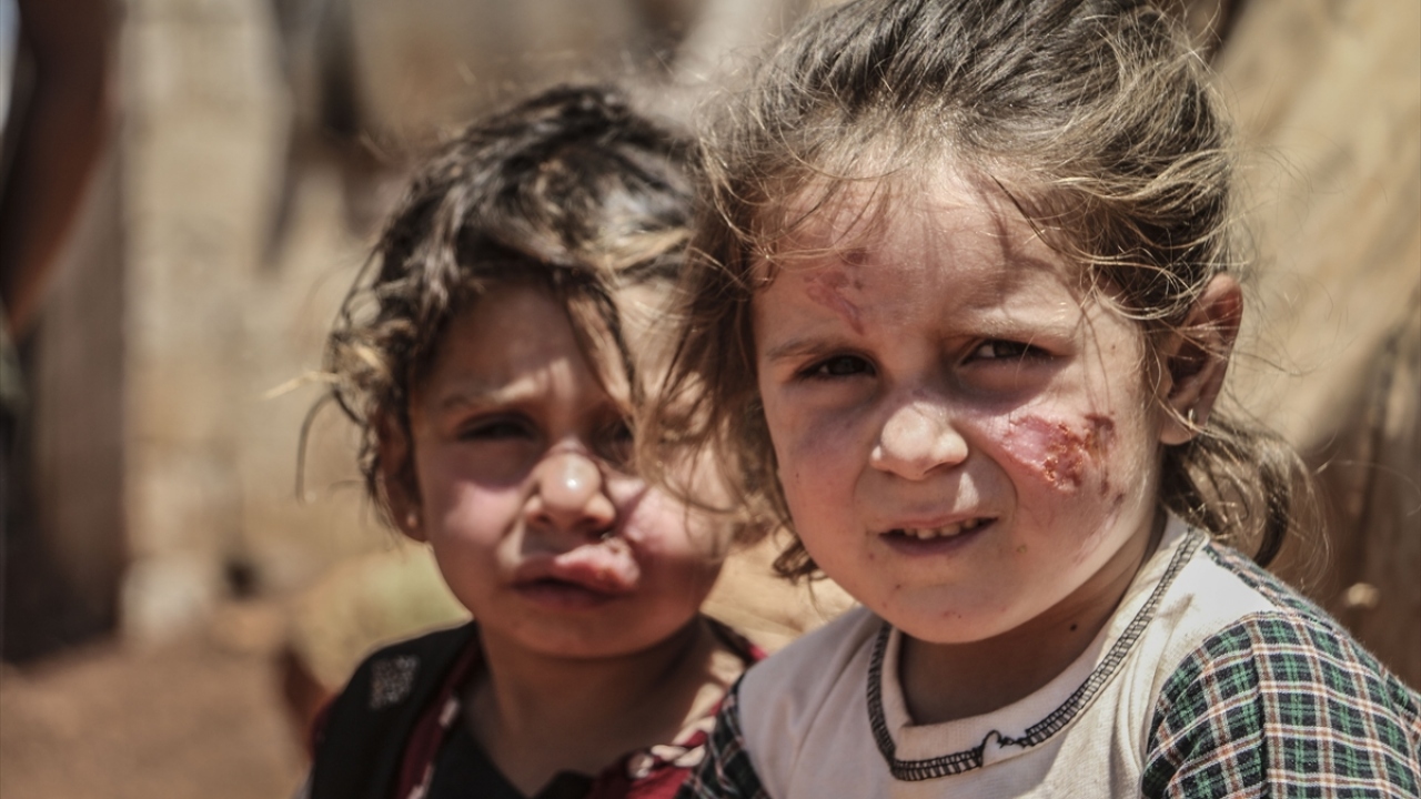 Beşşar Esed rejimi ve destekçilerinin saldırılarından kaçan sivillerin kaldığı kamplarda açıkta kalan foseptik çukurları ve zarar gören kanalizasyon başta olmak üzere altyapı sorunları nedeniyle şark çıbanı tehlikesi baş gösterdi.