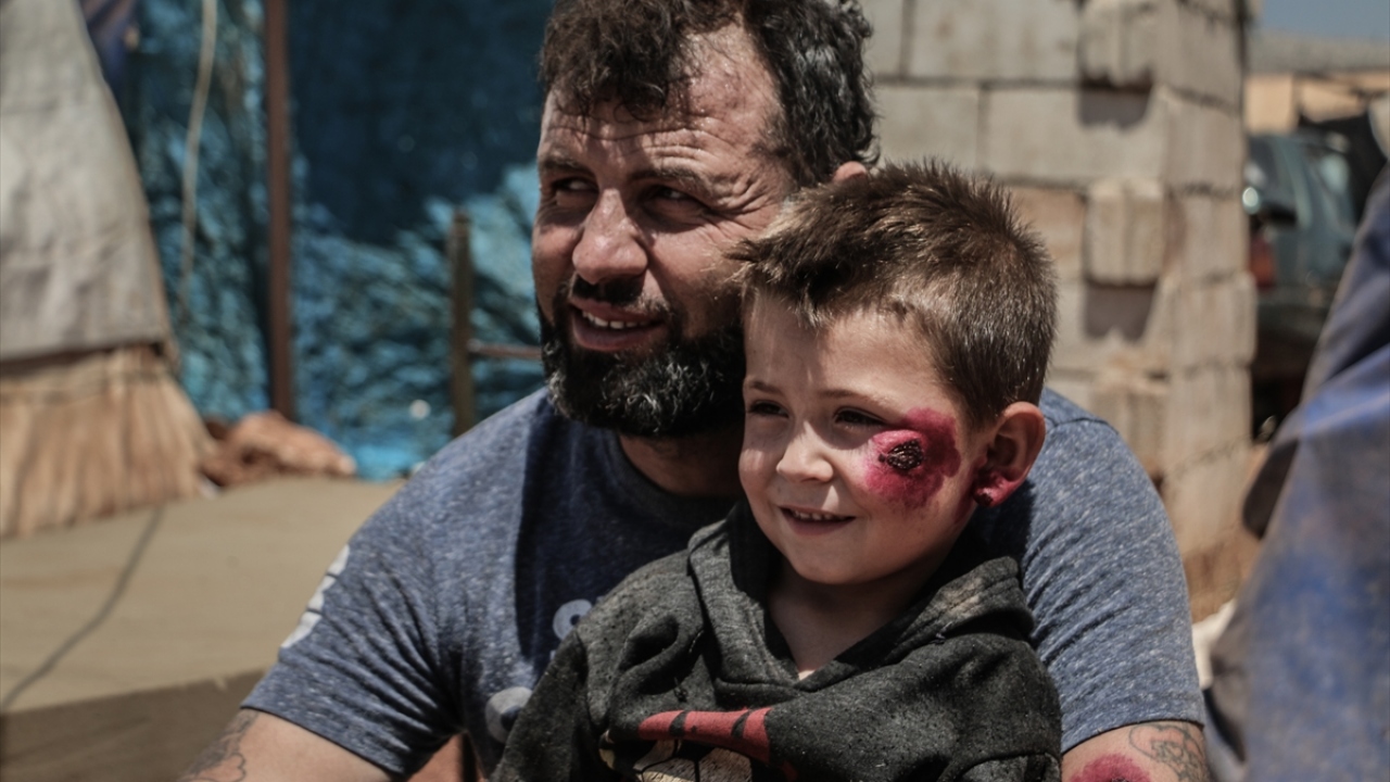 Saldırılardan kaçarak ailesiyle Şam el Hayır kampına sığınan Muhammed el İbrahim, yaptığı açıklamada, ailesinden 7 kişiye şark çıbanı bulaştığını söyledi.