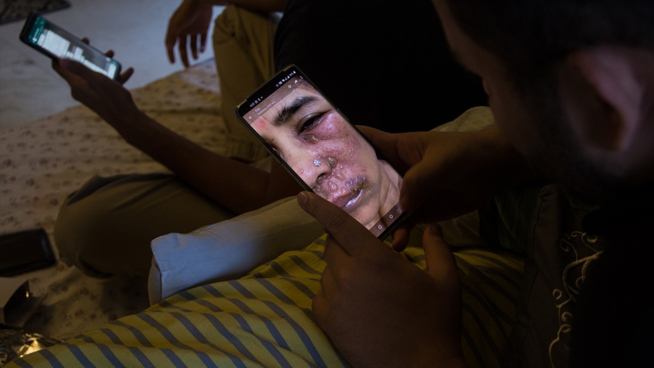 Vatandaşlara hizmet etmenin yanı sıra hem onların evde güvende kalmalarını sağlayan hem de hastanelerin yükünü azaltan genç doktorlar, 7 gün 24 saat kendilerini arayanlara cevap verip doğru tedavi konusunda yardımcı oluyor. 