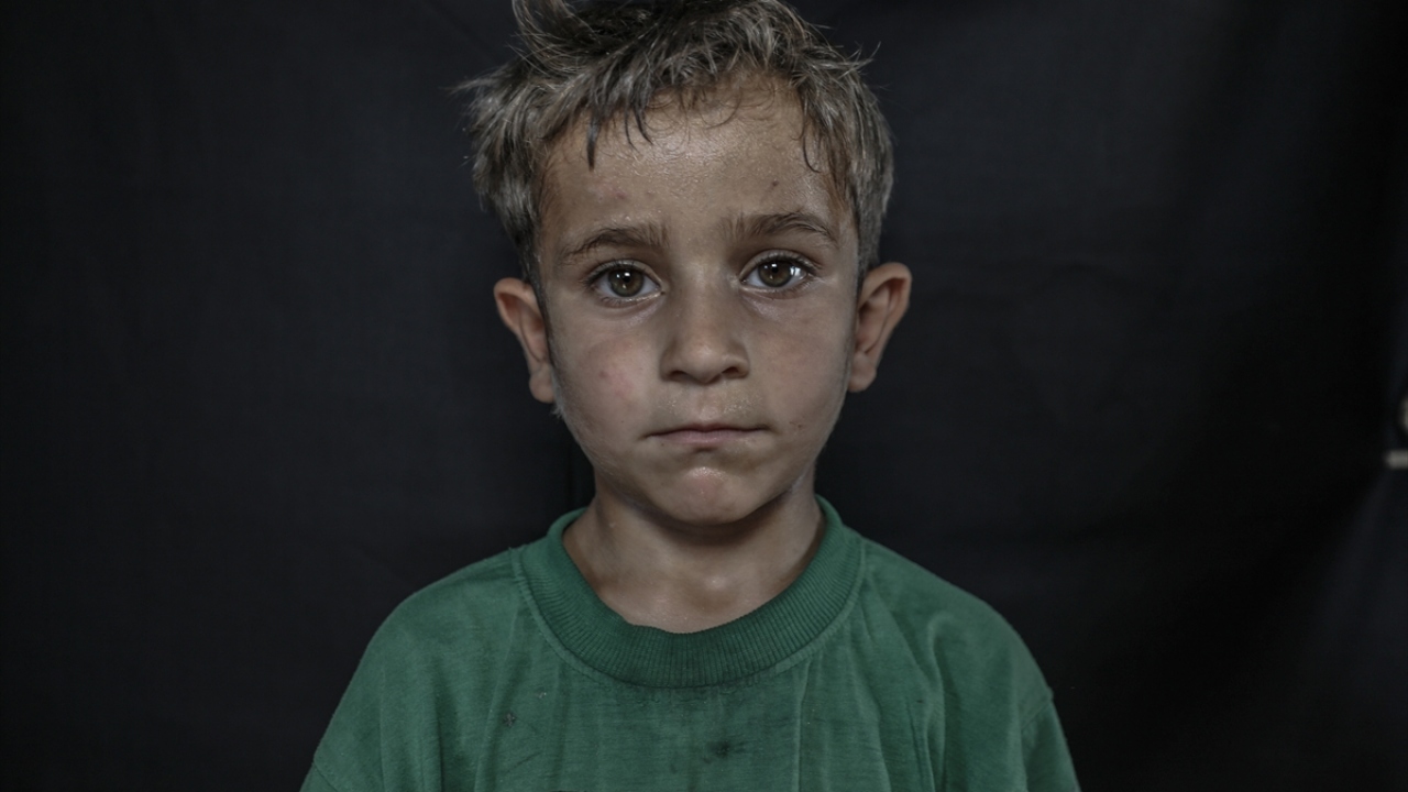 İdlib`de gönüllü kuaförler, Beşşar Esed rejiminin saldırılarından kaçarak sınır hattındaki Dıya kampına sığınan yüzlerce çocuğun saçlarını düzelterek onları sevindirdi.