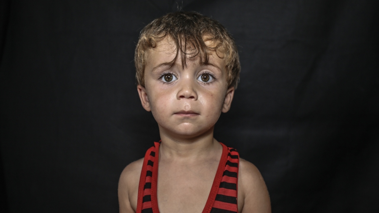 Dıya kampındaki çocukların saçını ören Kuaför Meryem El Kaddur, yaptığı açıklamada, iç savaşın sürdüğü ülkedeki çocuklara bu durumu bir süreliğine de olsa unutturmayı istediklerini söyledi.