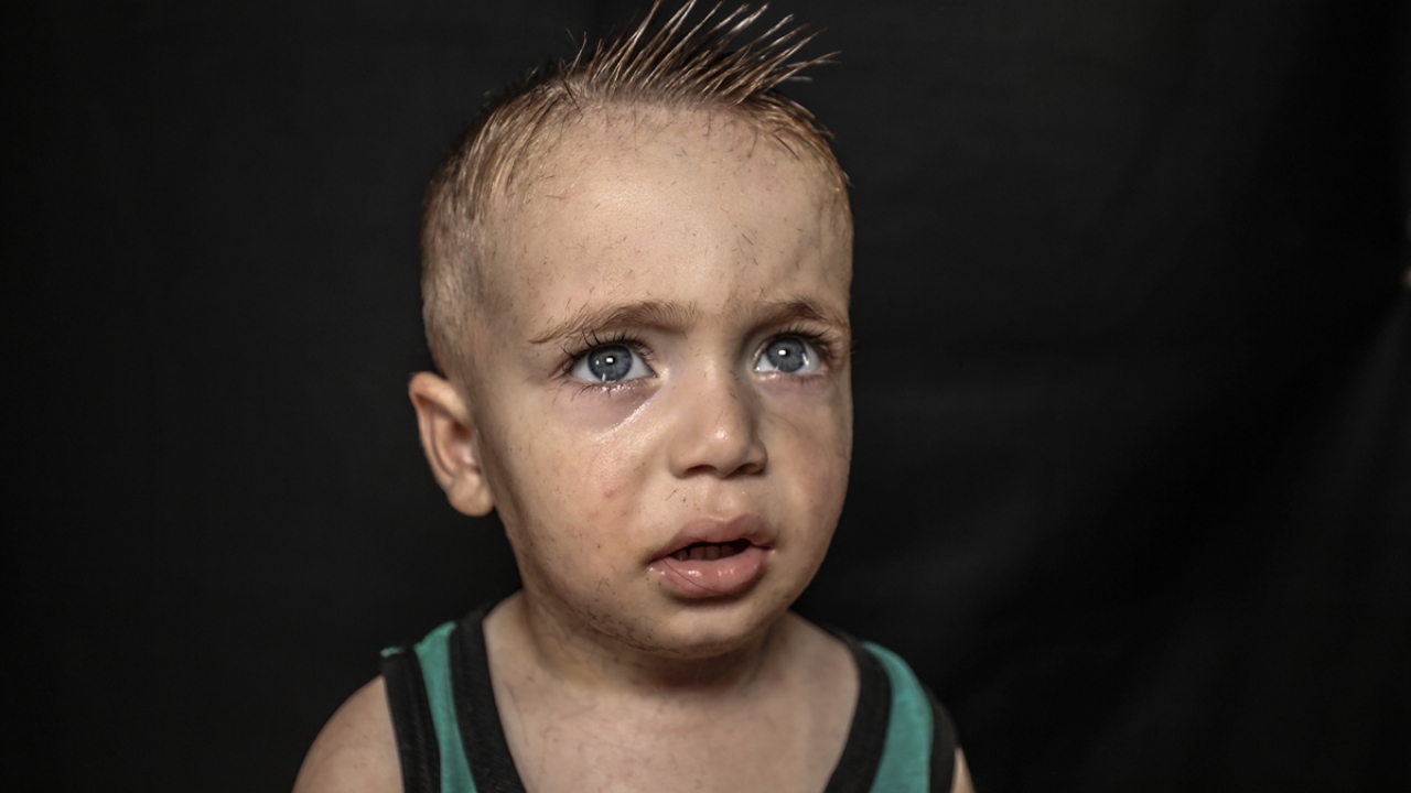 Esed rejimi ve destekçilerinin saldırılardan kaçarak Has kampına sığınan Muhammed Kemal de, "Bayramlarda ben ve arkadaşlarım, kuaför salonuna gelip ücretsiz tıraş oluyoruz." ifadelerini kullandı 