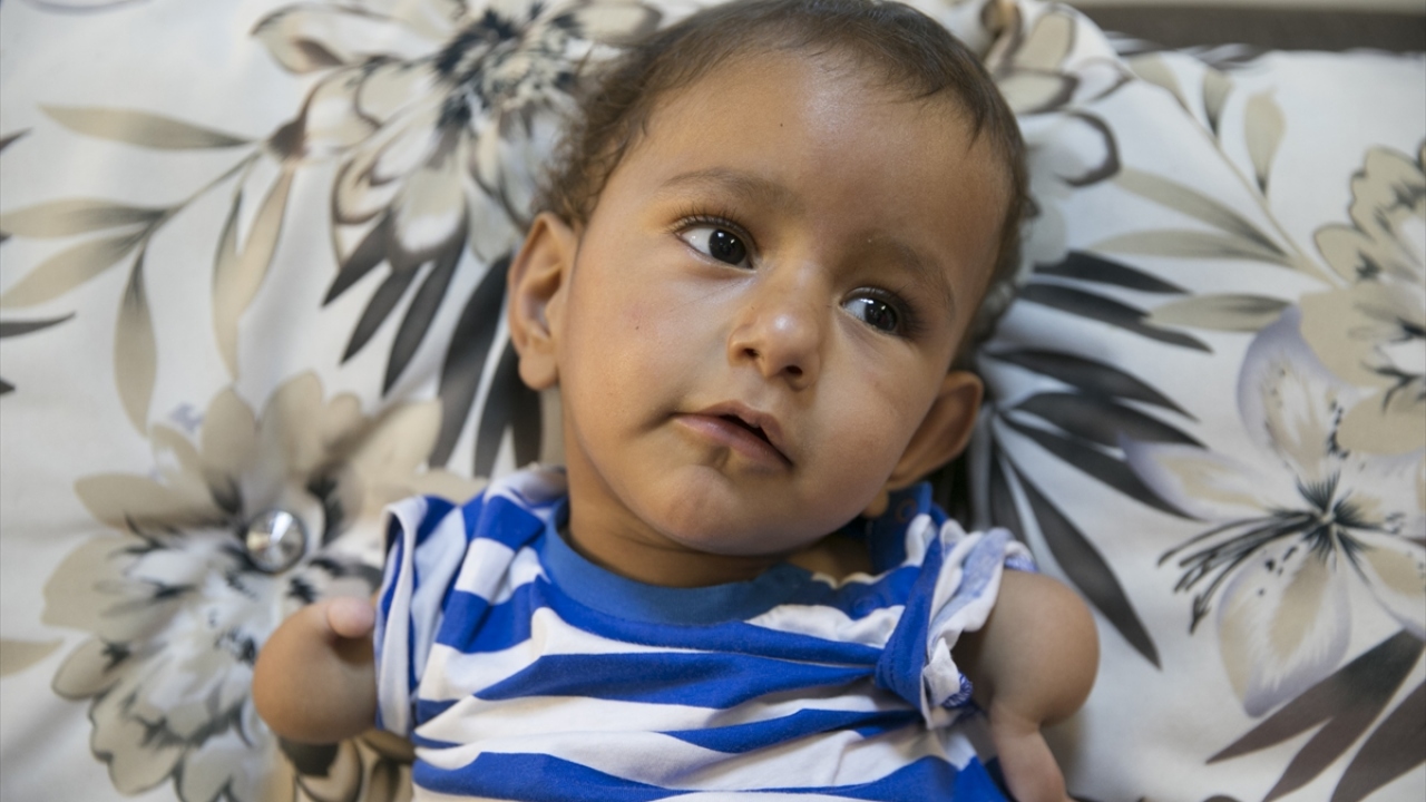 İdlibli Muhammed bebek, tetkikler için hastaneye götürüldü