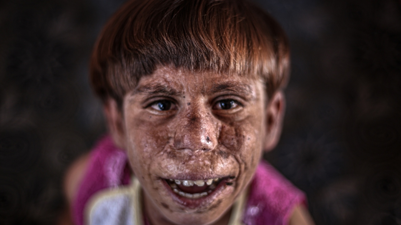 Gününün büyük bir kısmını, sığınağa dönüştürdükleri okulun boş sınıfları ve avlusunda kardeşleriyle geçiren Meryem`in tek hayali, hastalığını yenip kendisinden uzak duran yaşıtlarıyla çekinmeden doyasıya oyunlar oynayabilmek.