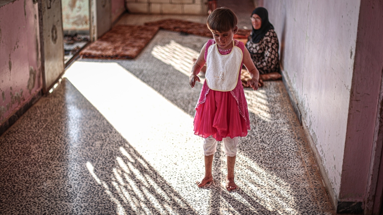 Meryem, bölgedeki hastanelerin ve sağlık kuruluşlarının rejim ve destekçilerince defalarca bombalanarak tahrip edilmesi sonucu gerekli tedavilerden yıllarca mahrum kaldı.
