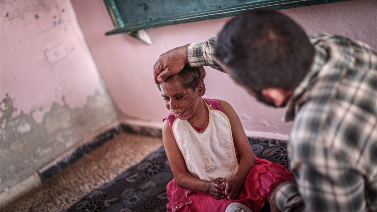 34 yaşındaki çaresiz baba Sah, Meryem`in ilaç ve sürekli tedaviye ihtiyaç duyduğunu ve Suriye`de tedavi imkanlarının yetersiz olduğunu söyledi.