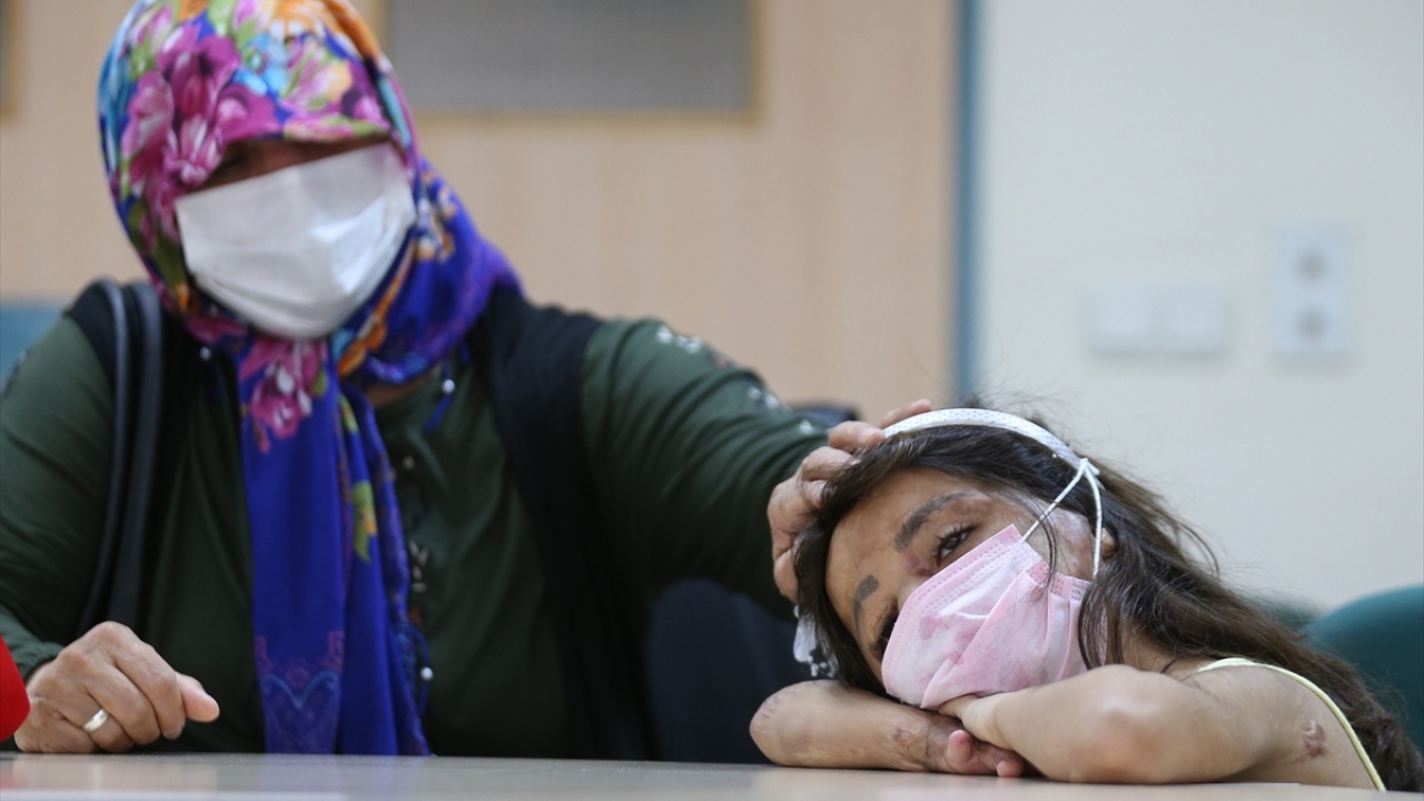 Anne Fatma Mansur Dimo, bombalı saldırı sonucu kızının yüzünün tanınmayacak hale geldiğini söyledi.