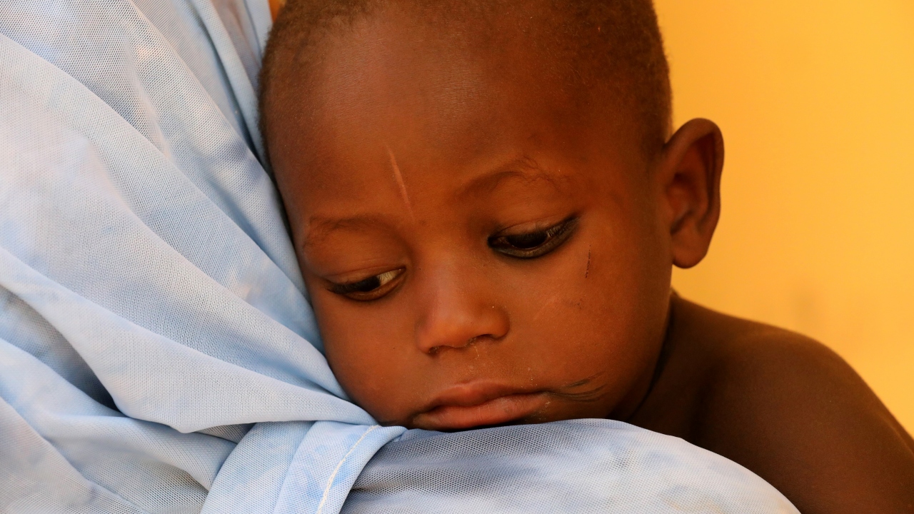 5 yaş altındaki çocukların bağışıklık sistemlerinin parazite direnecek kadar güçlü olmadığına dikkati çeken Ya`u, bu grubun, sıtmadan etkilenme ve ölme olasılığının daha yüksek olduğunu kaydetti.