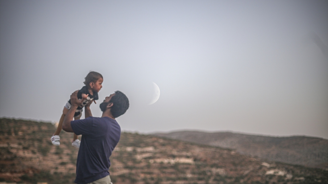 Ailesiyle 1 Eylül`de Türkiye`ye getirilen İdlibli Muhammed bebek, Ankara`da gerekli tetkiklerin ardından protez bacaklarına kavuştu.