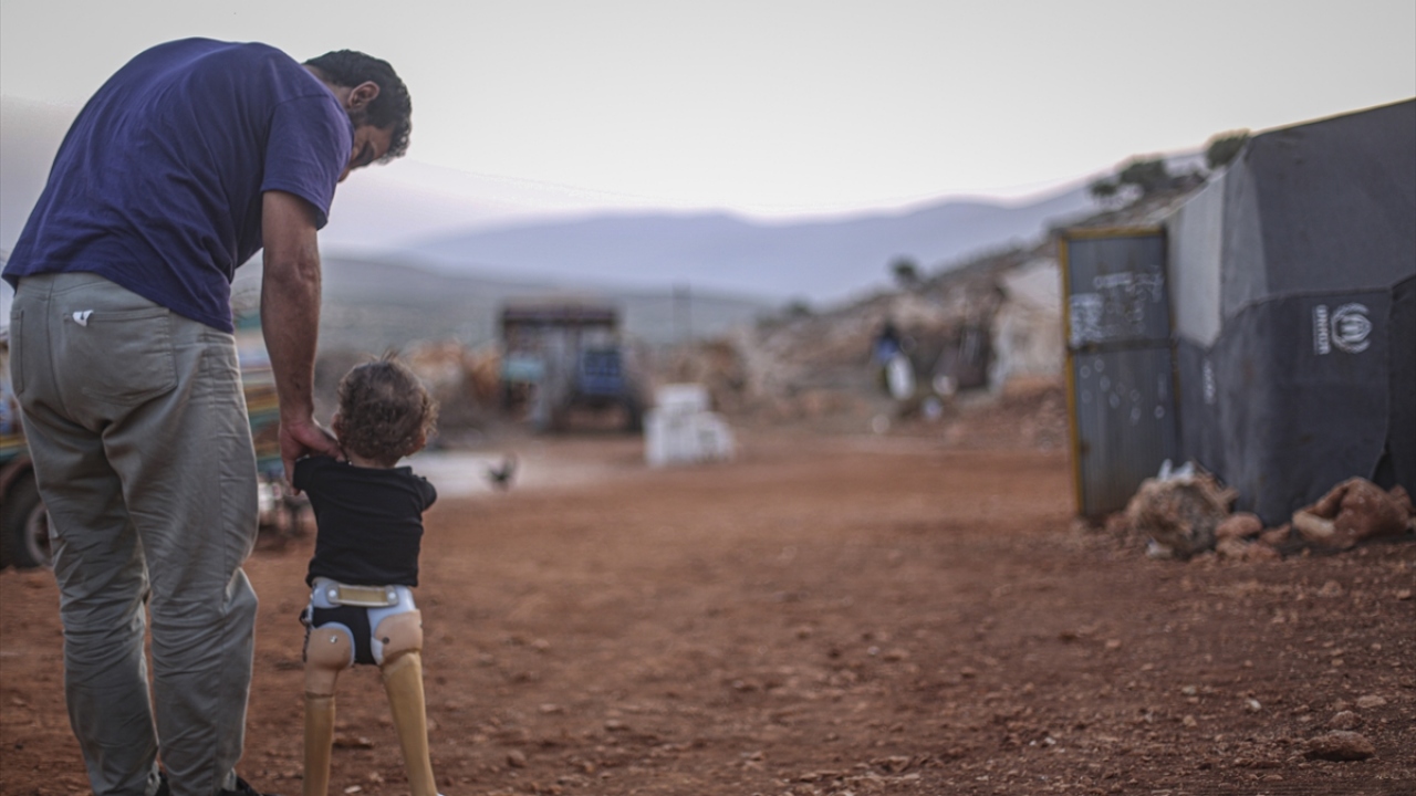 Mısaytıf, Türk halkının kendilerini çok iyi karşıladığını belirterek "Muhammed`in yapay bacaklarına alışması için bu protez takımını taktılar. İlerleyen dönemde inşallah üzerinde yürüyebileceği başka bir protez takılacak." diye konuştu.