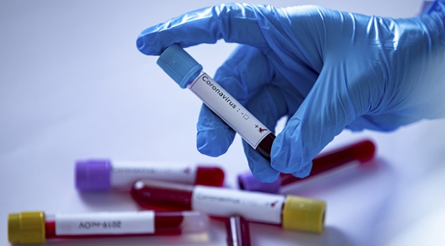 Menemenspor'da 30 kişinin COVID-19 testi pozitif