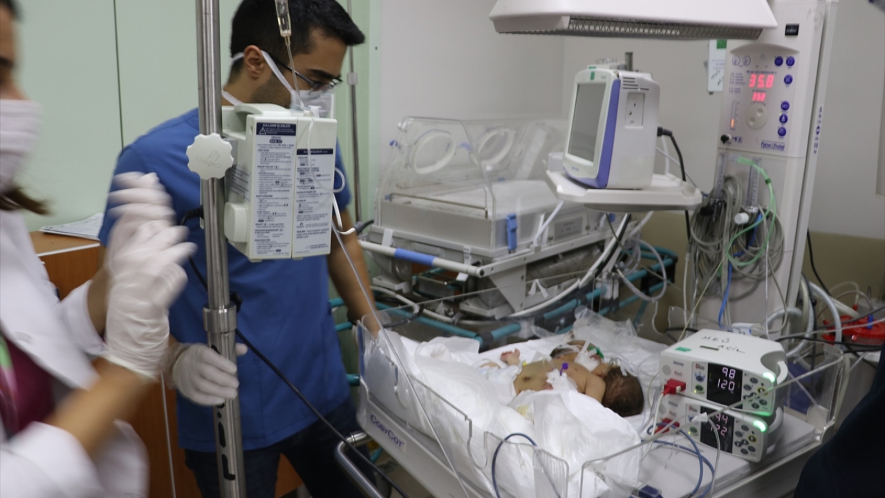 Dünyaya 4 kilo 200 gram gelen yapışık ikiz bebekler, Hatay`ın Kumlu ilçesindeki Zeytin Dalı Gümrük Kapısı`ndan ambulansla alınarak tedavileri için Hatay Mustafa Kemal Üniversitesi (MKÜ) Araştırma ve Uygulama Hastanesine getirildi.