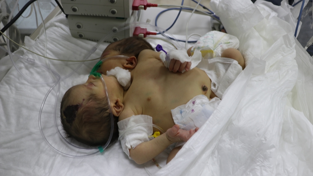 Yazarlı, bebeklerin tedavilerini yakından takip ettiklerini ve gerekli müdahaleleri yaptıklarını kaydetti.