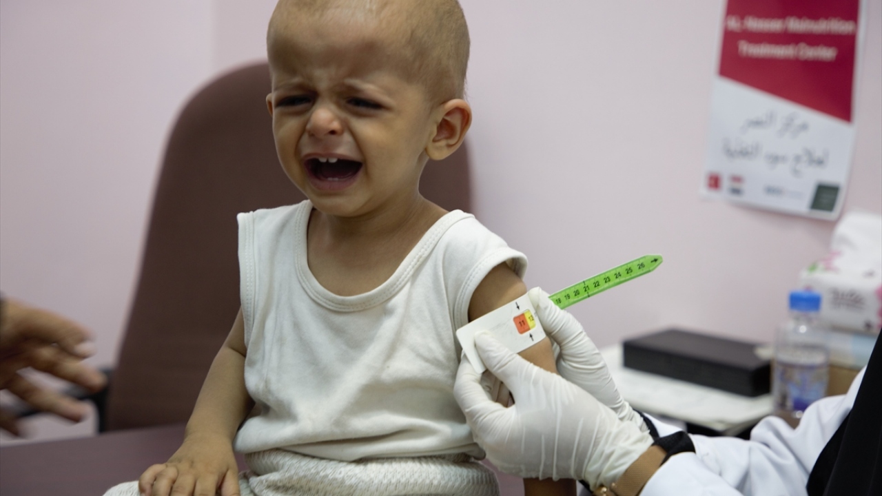 Yemen`de yürüttükleri faaliyetlerle ilgili değerlendirmelerde bulunan YYD Proje Koordinatörü Ahmet Fatih Ceyhan, ilk defa 2011 yılında Yemen yerel sağlık otoritelerinden gelen talep üzerine ülkeye giderek çalışmalara başladıklarını ifade etti.