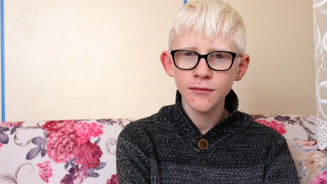 "İnsanların, albinizmli kişilere hoşgörülü davranmasını istiyorum"